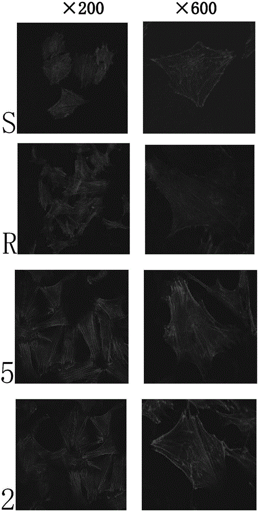 Method for detecting and evaluating in-vitro cell morphology and osteogenic function of surface of bone substitute implant