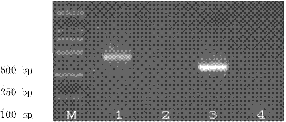 Apple stem grooving virus and prunus necrotic ringspot ilarvirus detection specific primers and probes and gene chips