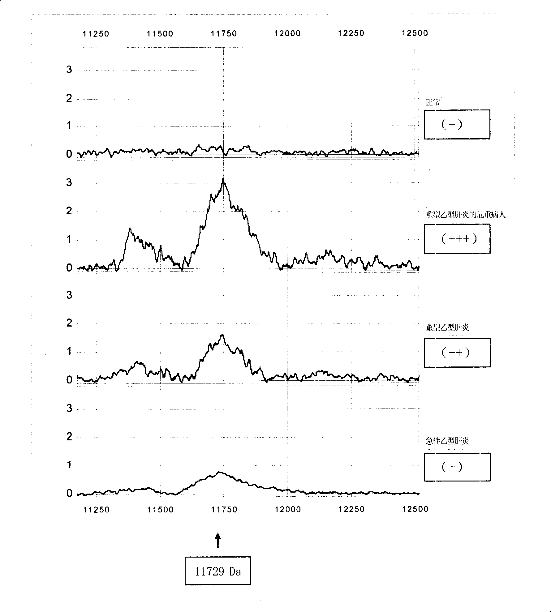 Novel mass spectrum analysis reagent box and method for detecting heavy hepatitis B