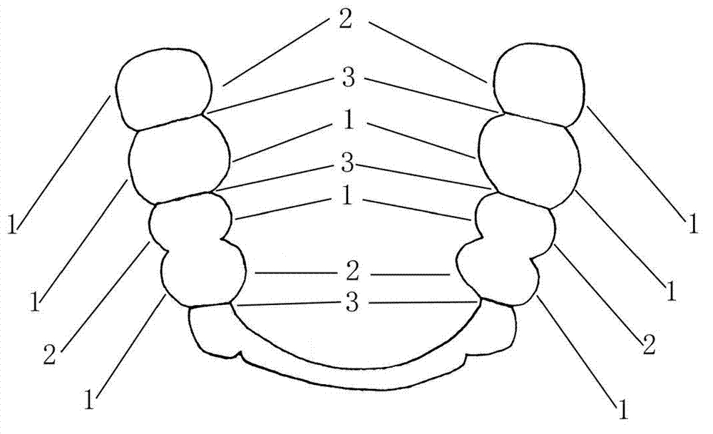 Base-free wrought wire orthodontic retainer