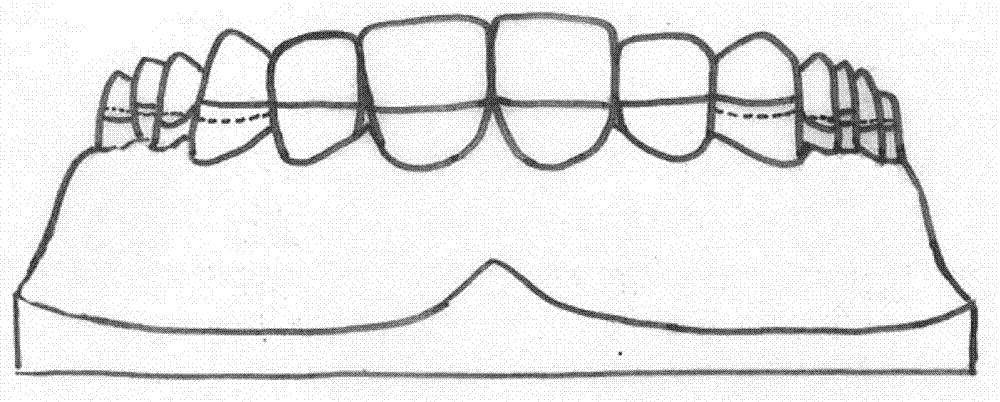 Base-free wrought wire orthodontic retainer