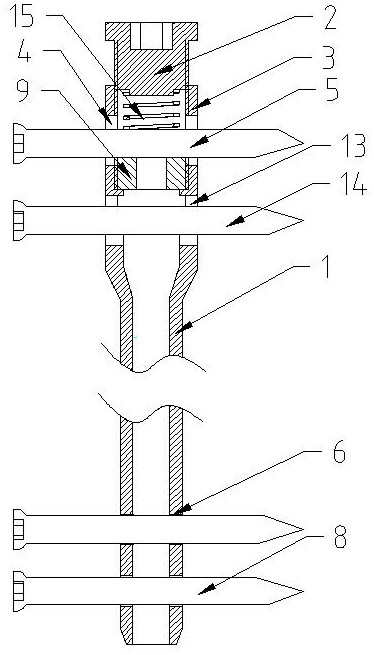 Bidirectional adjustable elastic intramedullary nail