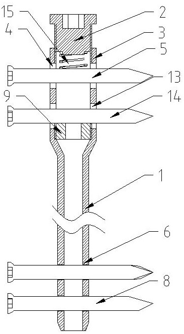 Bidirectional adjustable elastic intramedullary nail