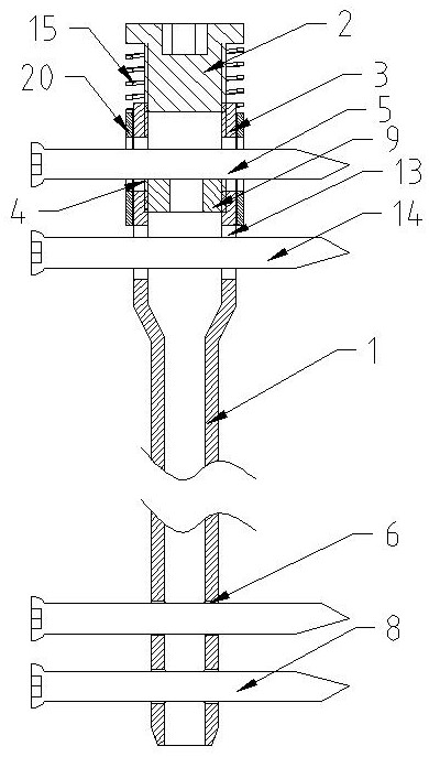 Bidirectional adjustable elastic intramedullary nail