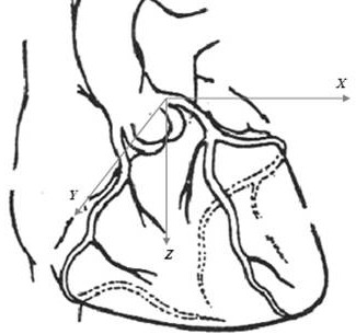 An automatic detection method of coronary calcified plaque based on cardiac CT images