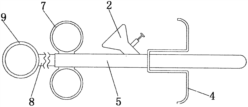 One-hand-operated bone powder implanting device