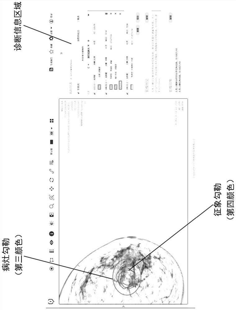 Display method, interaction method and storage medium of medical image