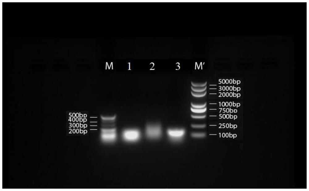 Medicine containing vincristine, its preparation method, pharmaceutical composition and application thereof