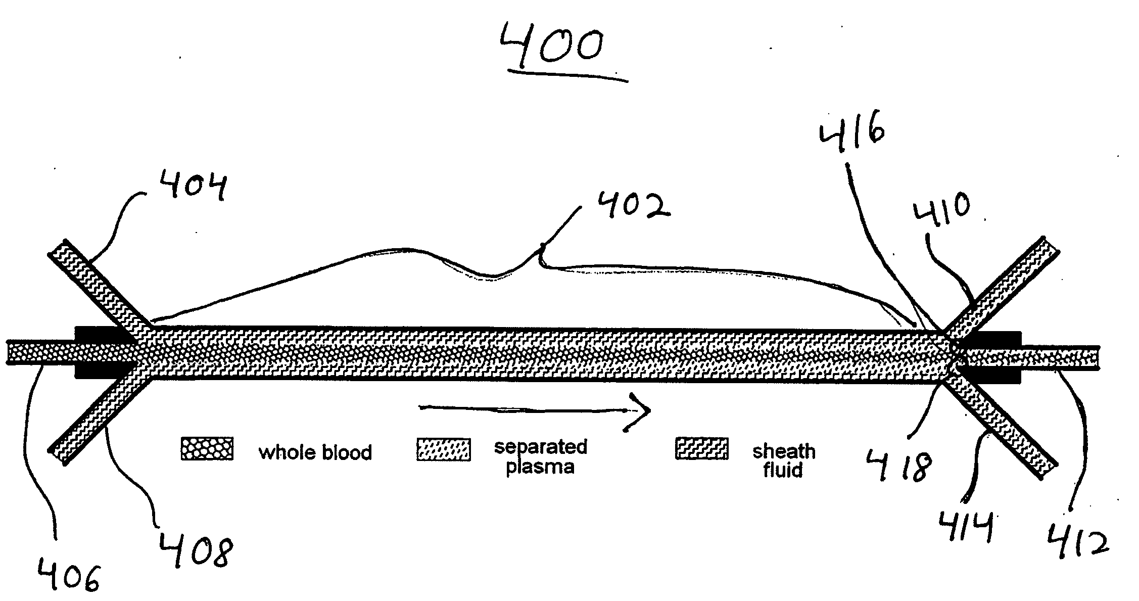 Systems and methods of blood-based therapies having a microfluidic membraneless exchange device