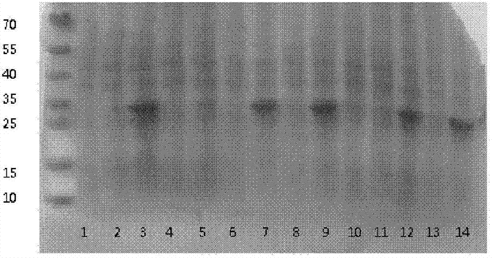 Human NT-proBNP preparation capable of stable preservation and preparation method thereof