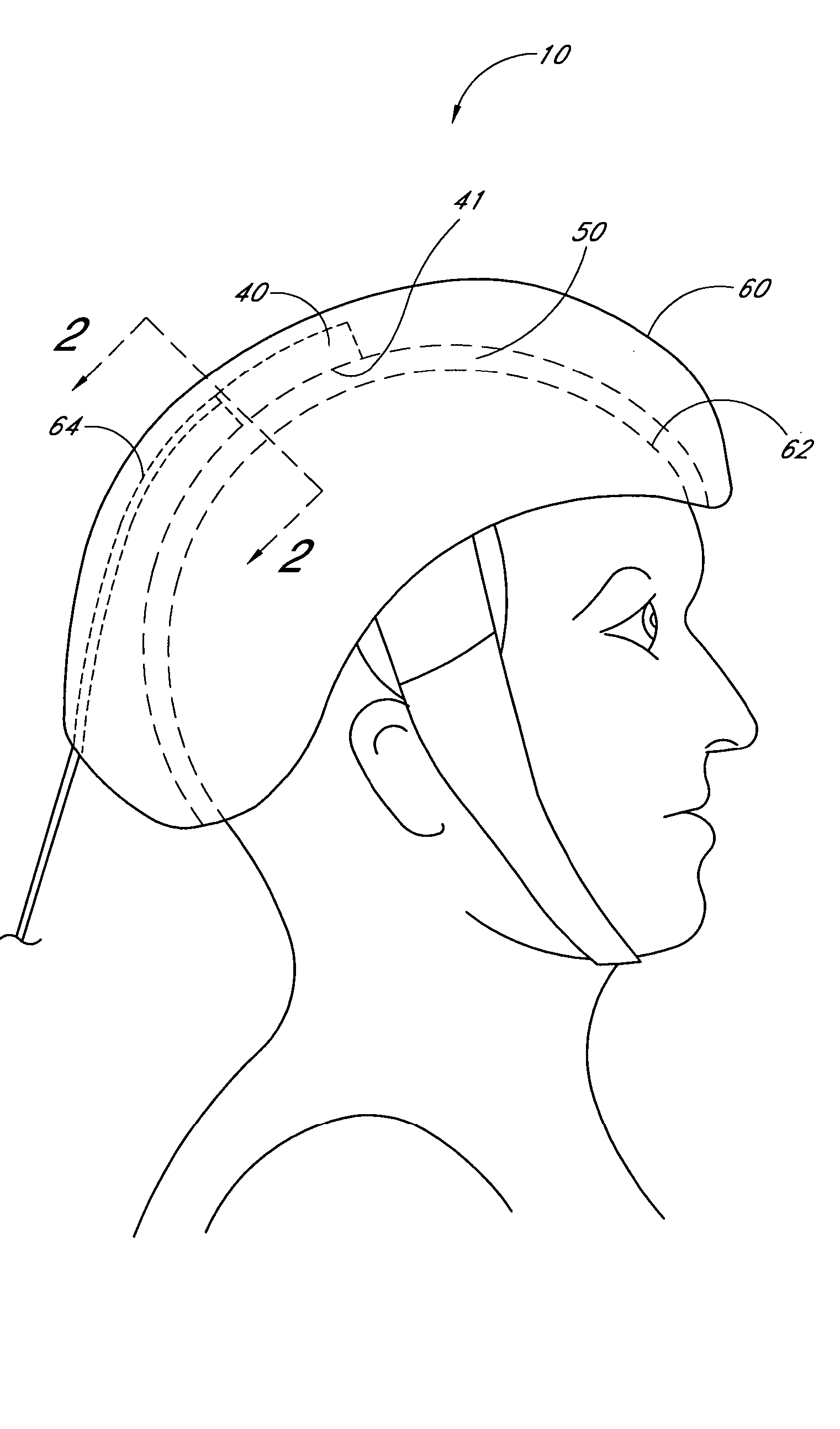 Device and method for providing phototheraphy to the brain