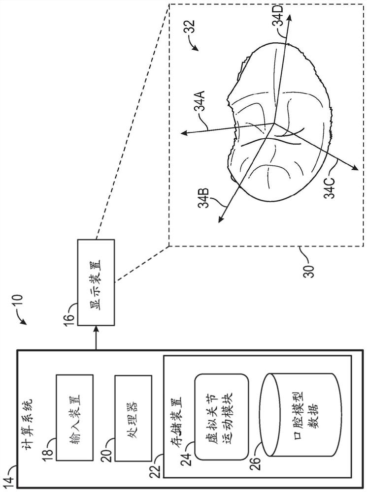 Virtual joint motion model for dental processing