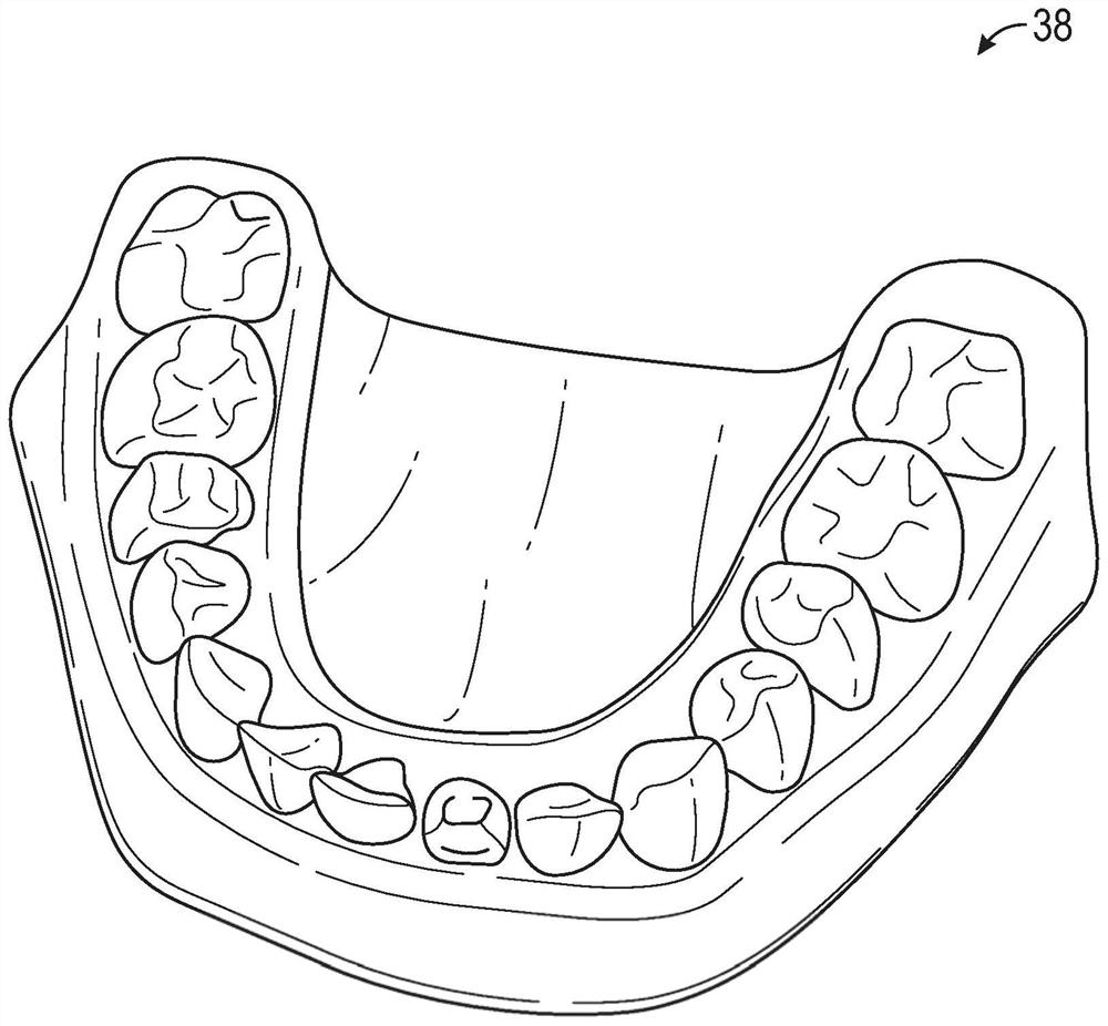 Virtual joint motion model for dental processing