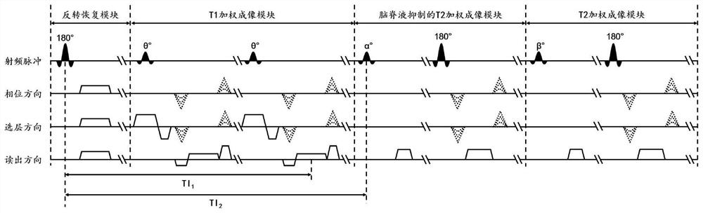 A magnetic resonance imaging method, device and storage medium