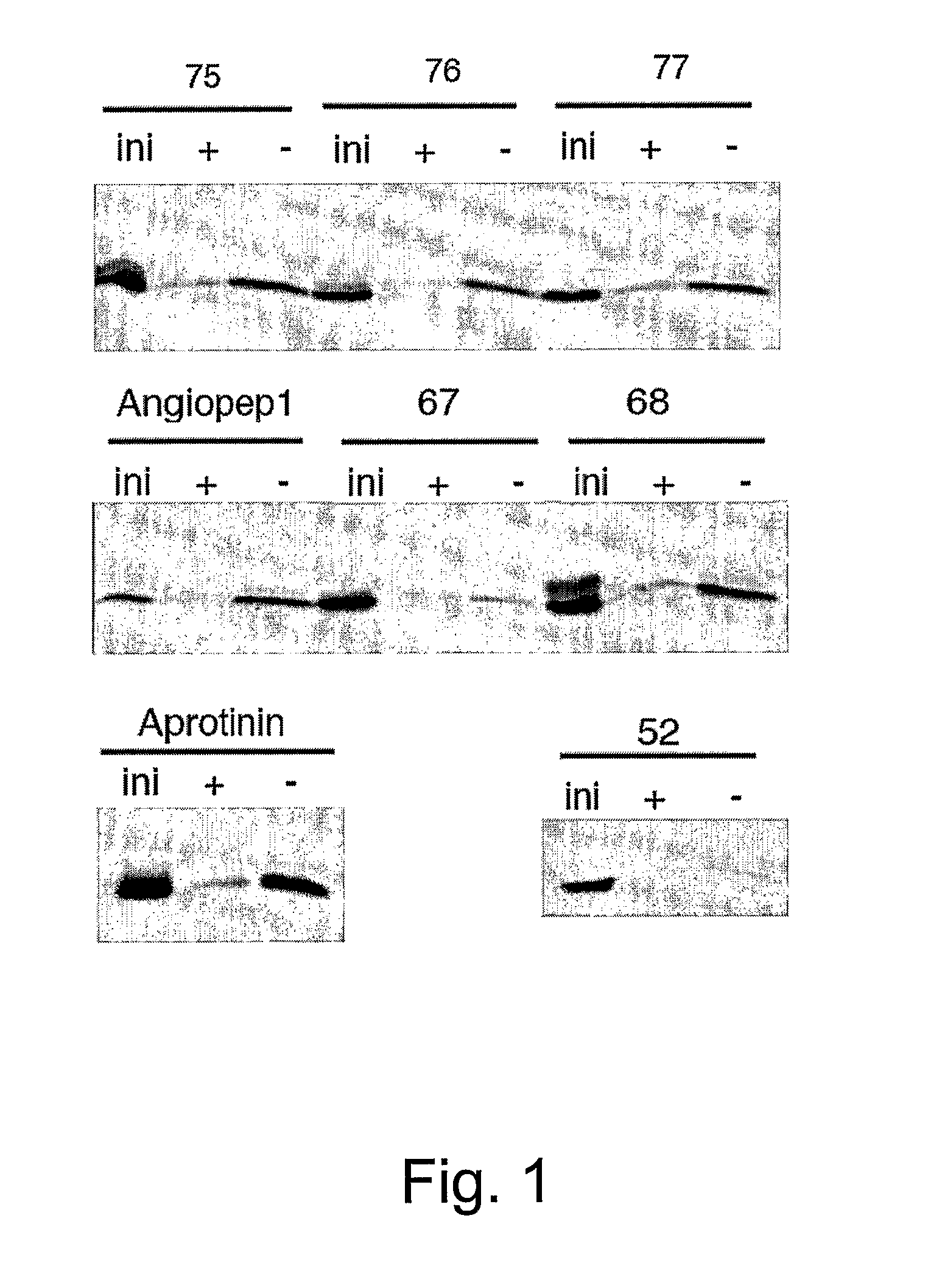 Aprotinin Polypeptides for Transporting a Compound Across the Blood-Brain Barrier