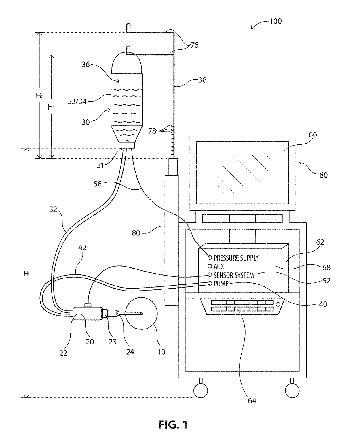 System, Apparatus and Method for Maintaining Anterior Chamber Intraoperative Intraocular Pressure