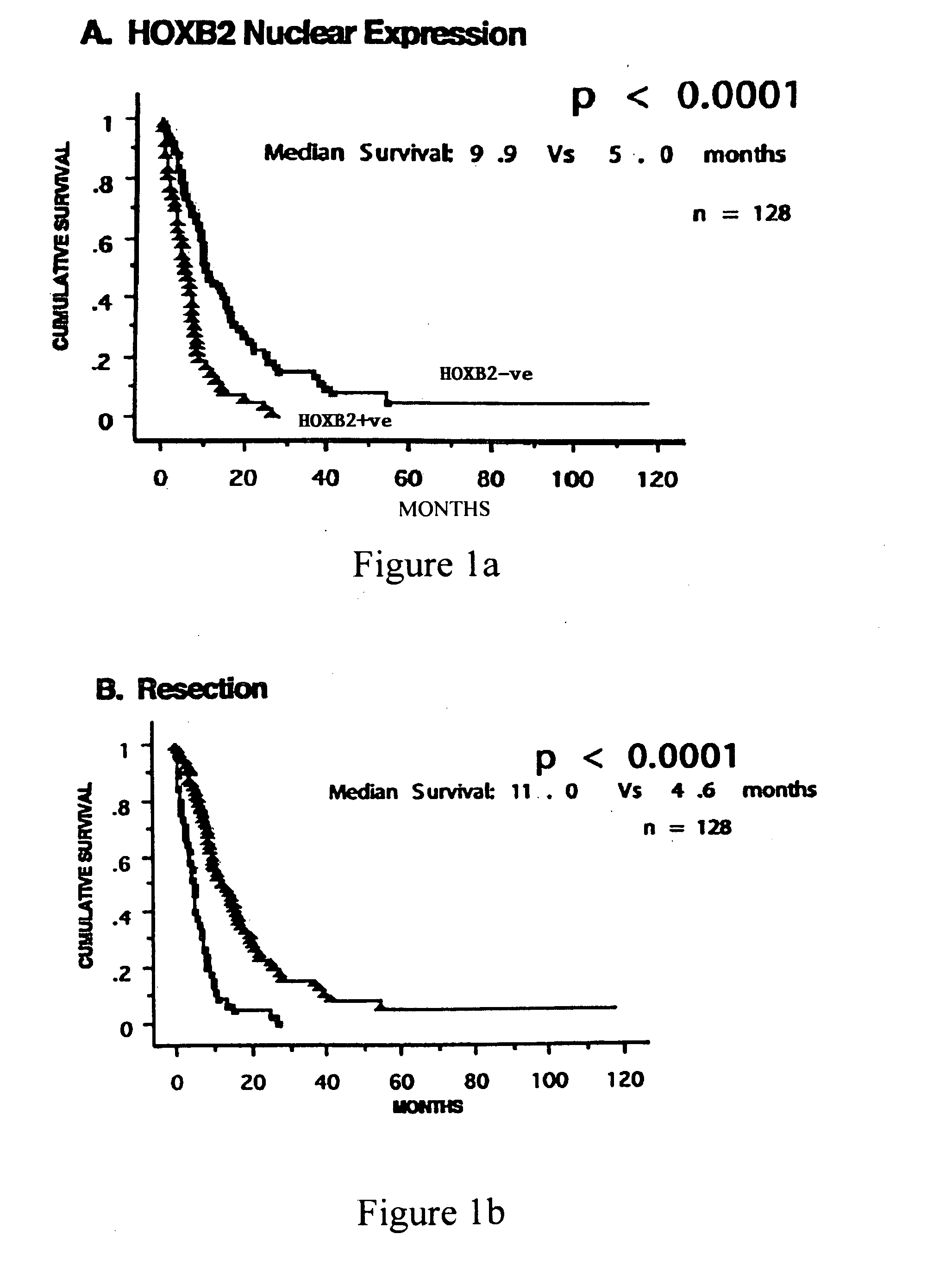 Methods of diagnosis and prognosis of pancreatic cancer