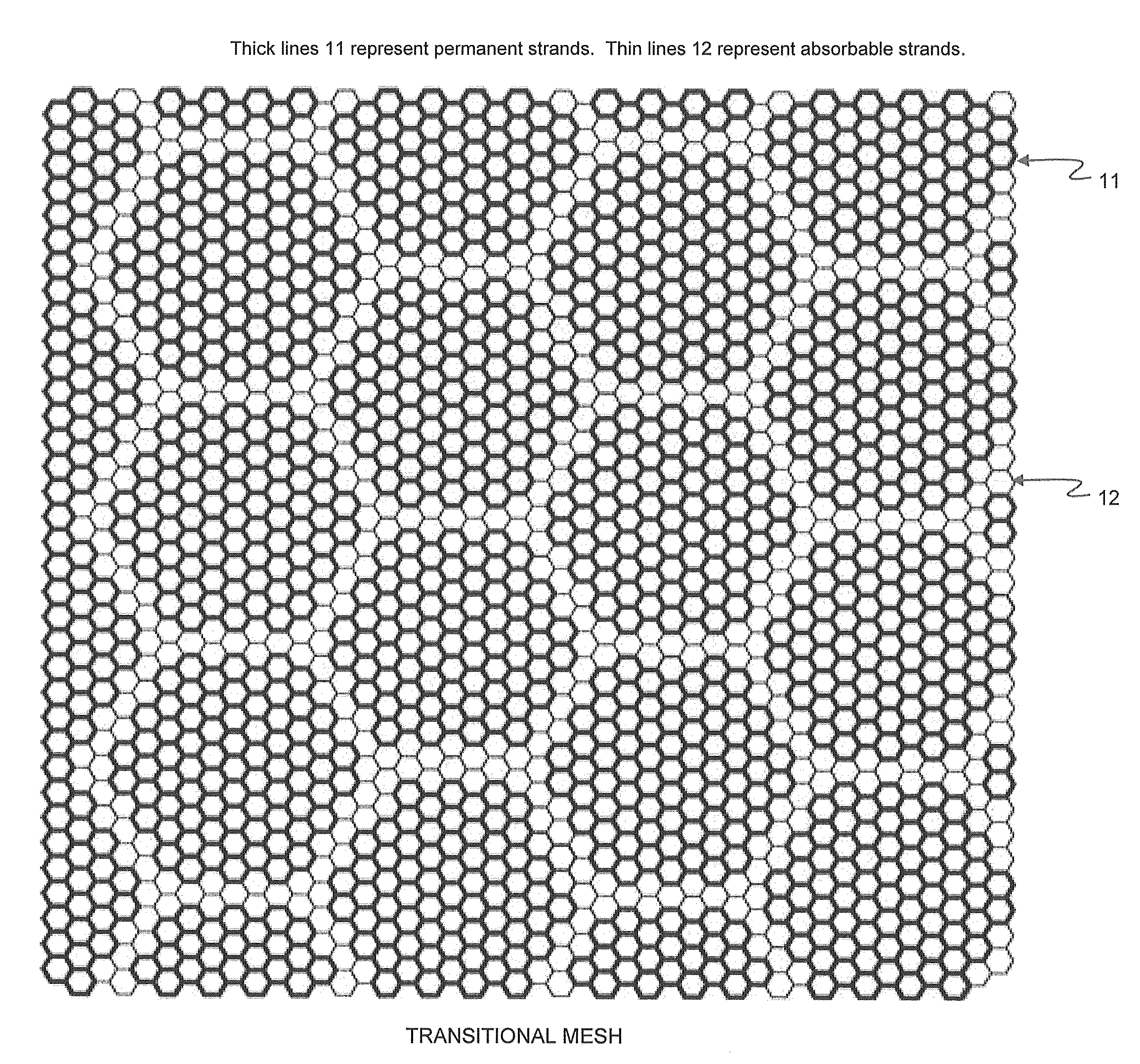 Supporting and Forming Transitional Material for Use in Supporting Prosthesis Devices, Implants and to Provide Structure in a Human Body