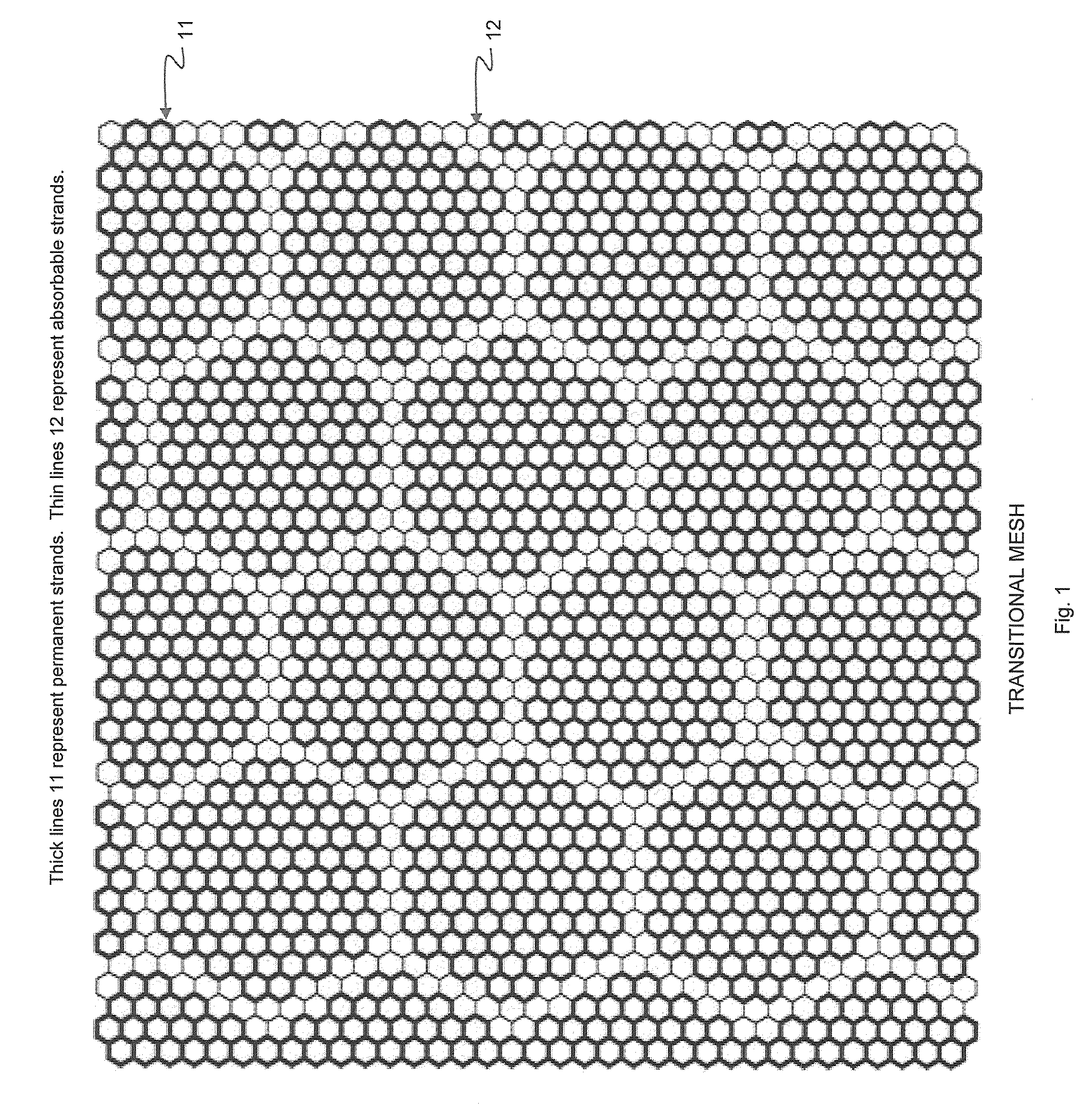 Supporting and Forming Transitional Material for Use in Supporting Prosthesis Devices, Implants and to Provide Structure in a Human Body