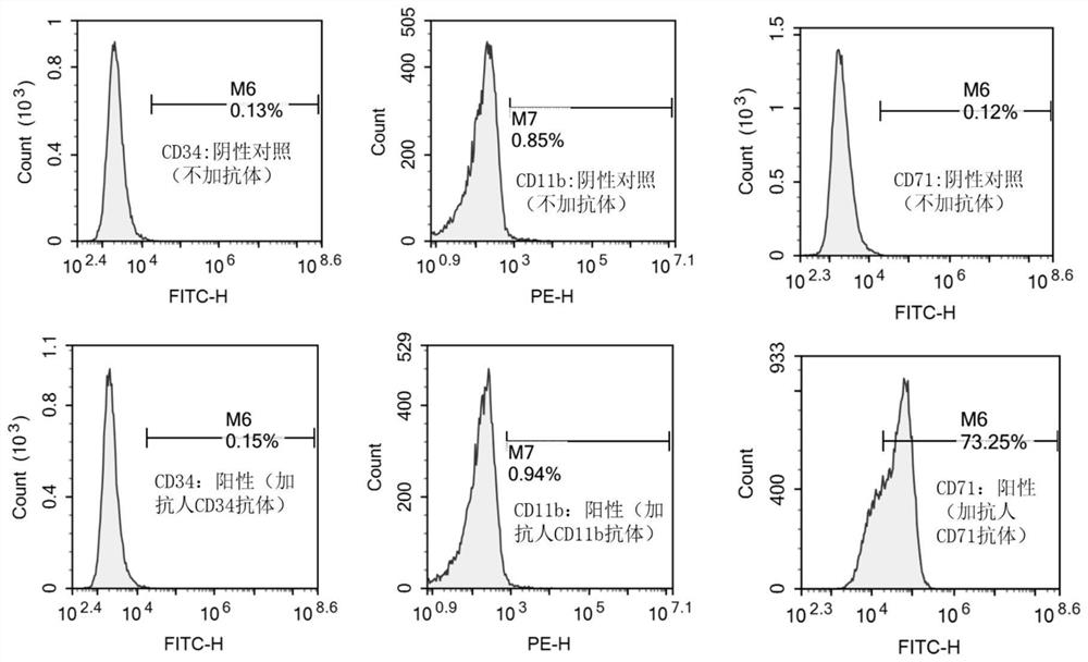 A kind of human primary myelofibrosis cell line and its application