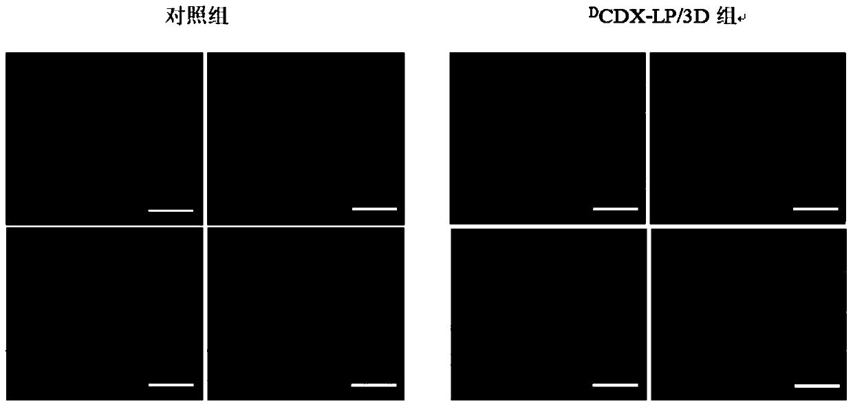 Application of P-glycoprotein inhibitors in drug delivery system modified by DCDX