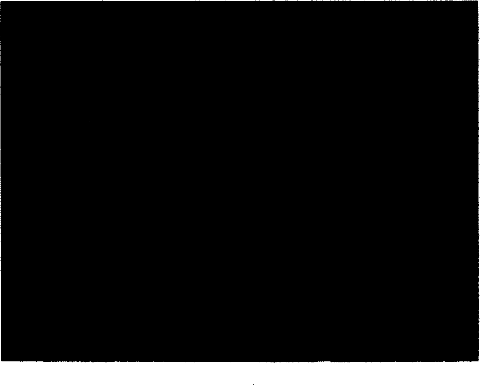 Retrovirus carrier of bone morphogenetic protein 4 gene and its use