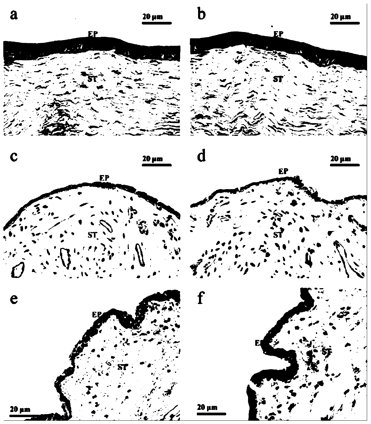 Tetrandrine lipid nanoparticle ophthalmic preparation and preparation method thereof