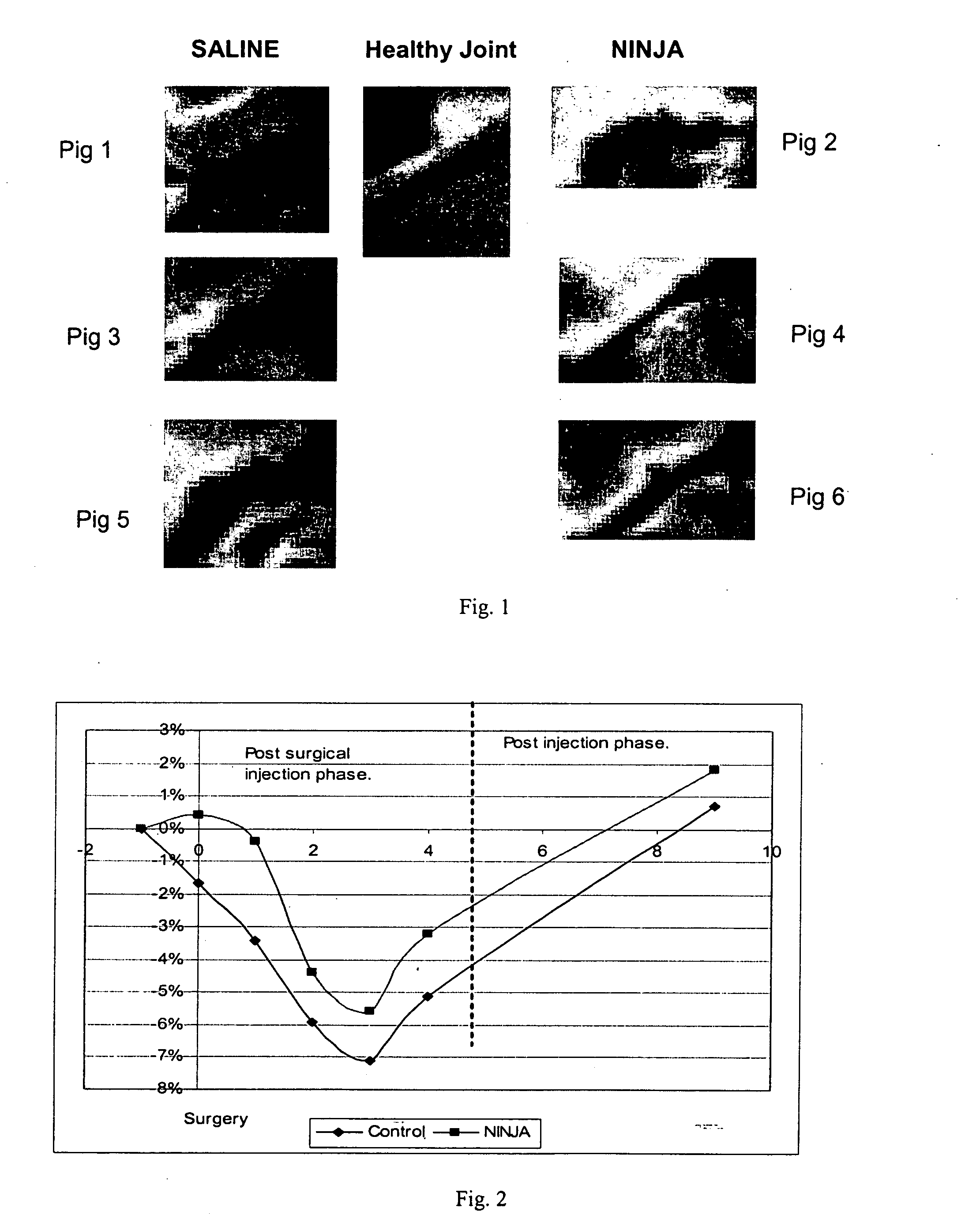 Polymer gel containing hyaluronic acid and collagen, and its use in joints