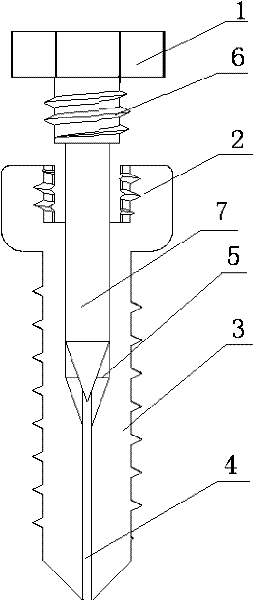 Expansive orthodontic anchorage implant