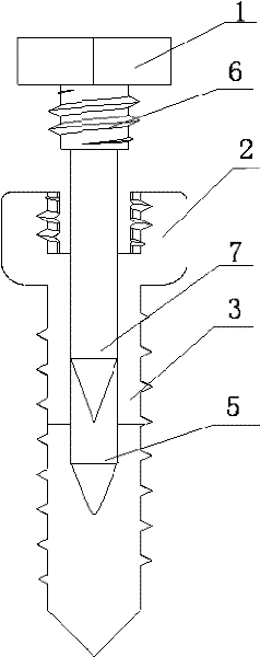 Expansive orthodontic anchorage implant