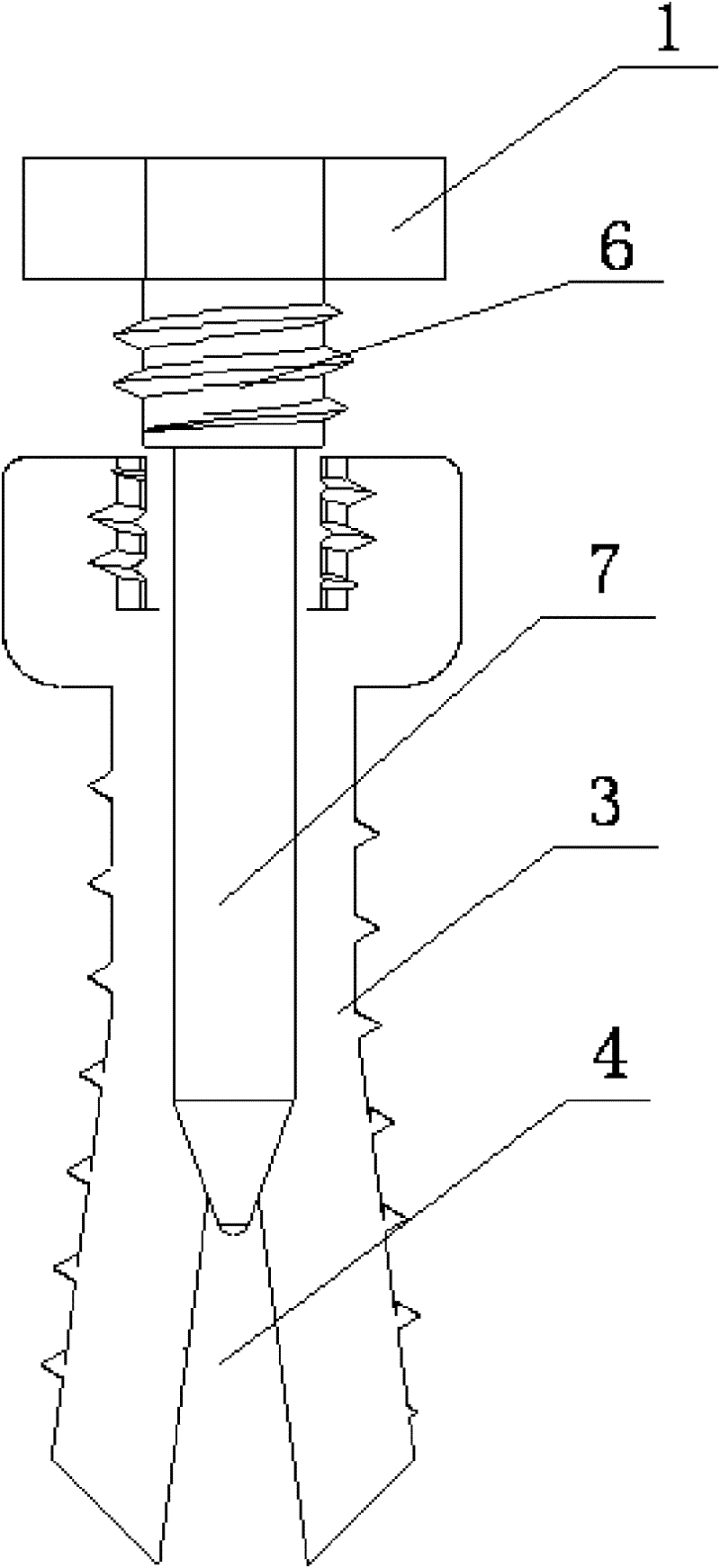 Expansive orthodontic anchorage implant