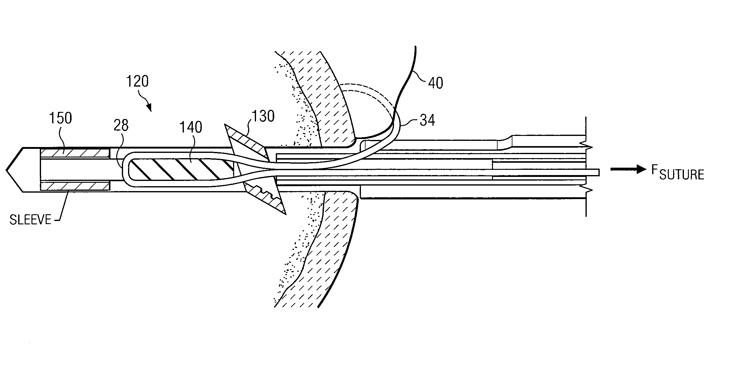 Knotless suture anchor having discrete polymer components and related methods