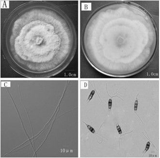 Pestalotiopsis crassipes