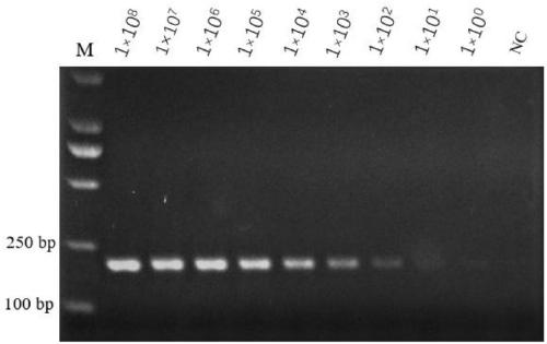 Specific gene of Acinetobacter baumannii and primer and application thereof