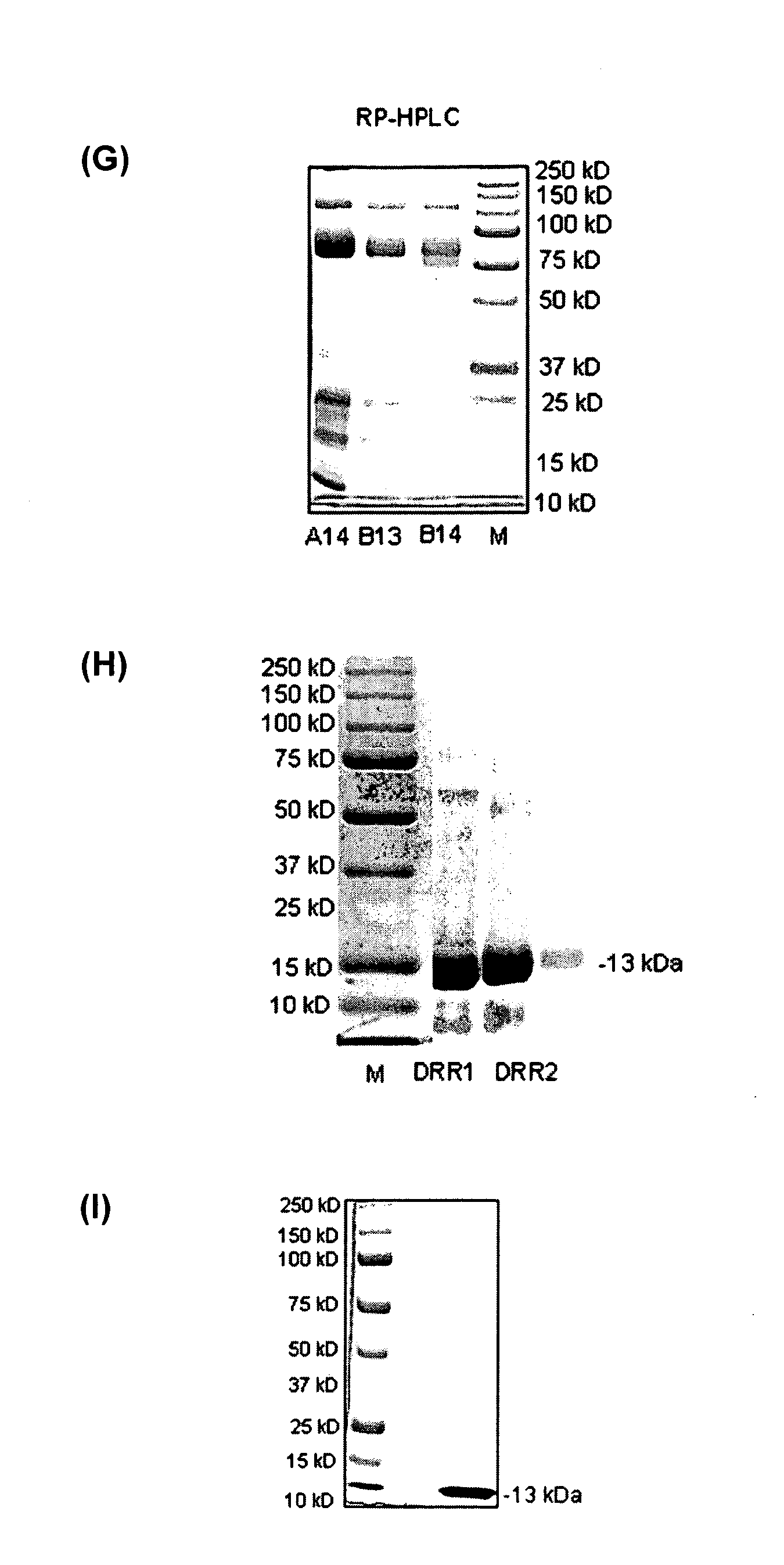 Phospholipase(s) and use(s) thereof