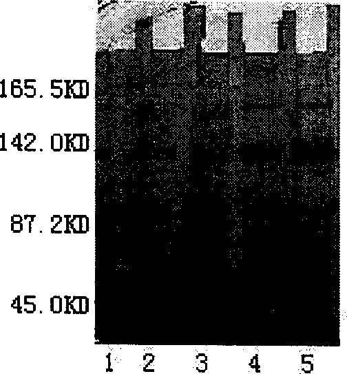 Enzyme linked immune detection method of patient thrombocyte antibody and cross matching type