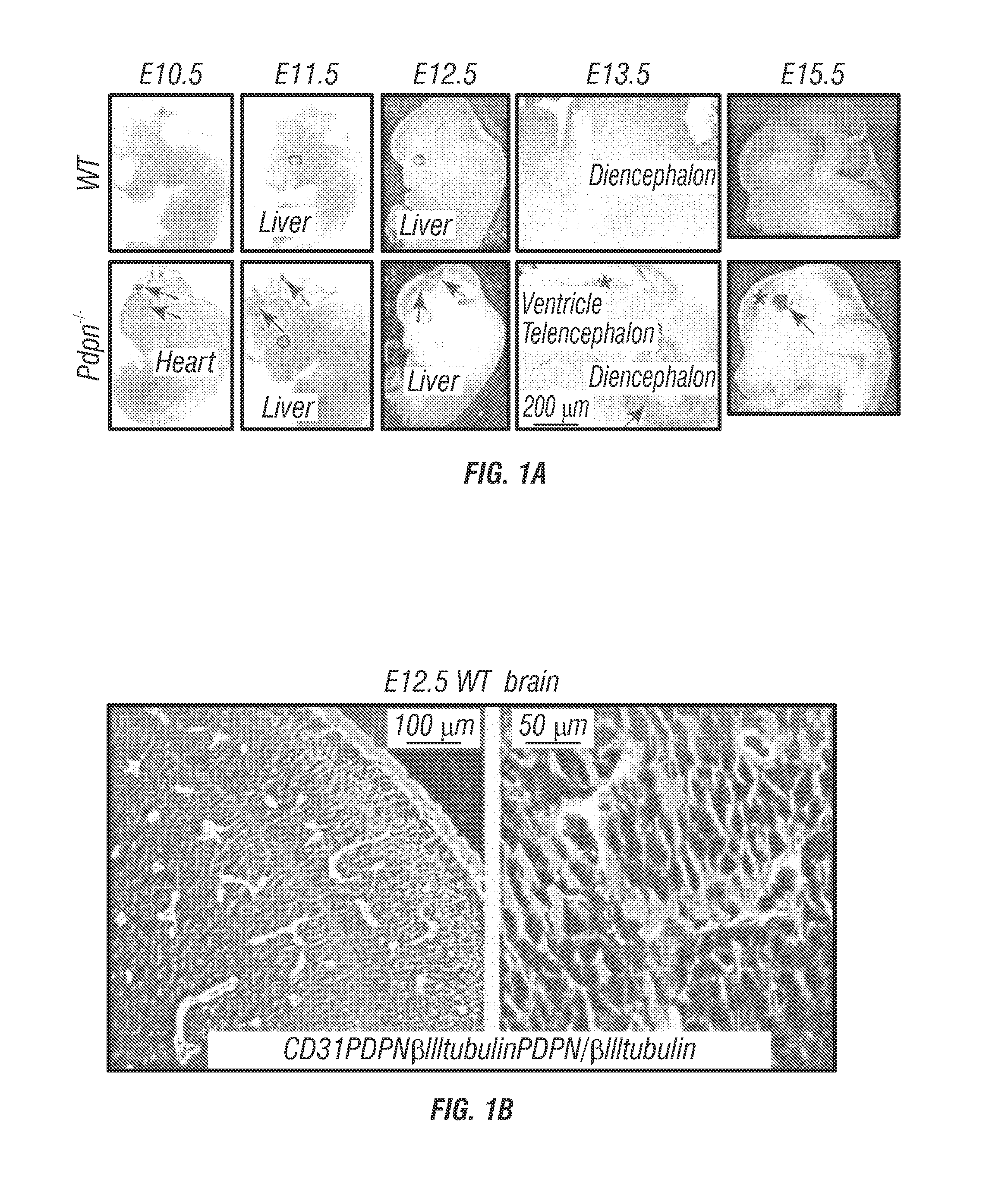 Modulation of podoplanin mediated platelet activation