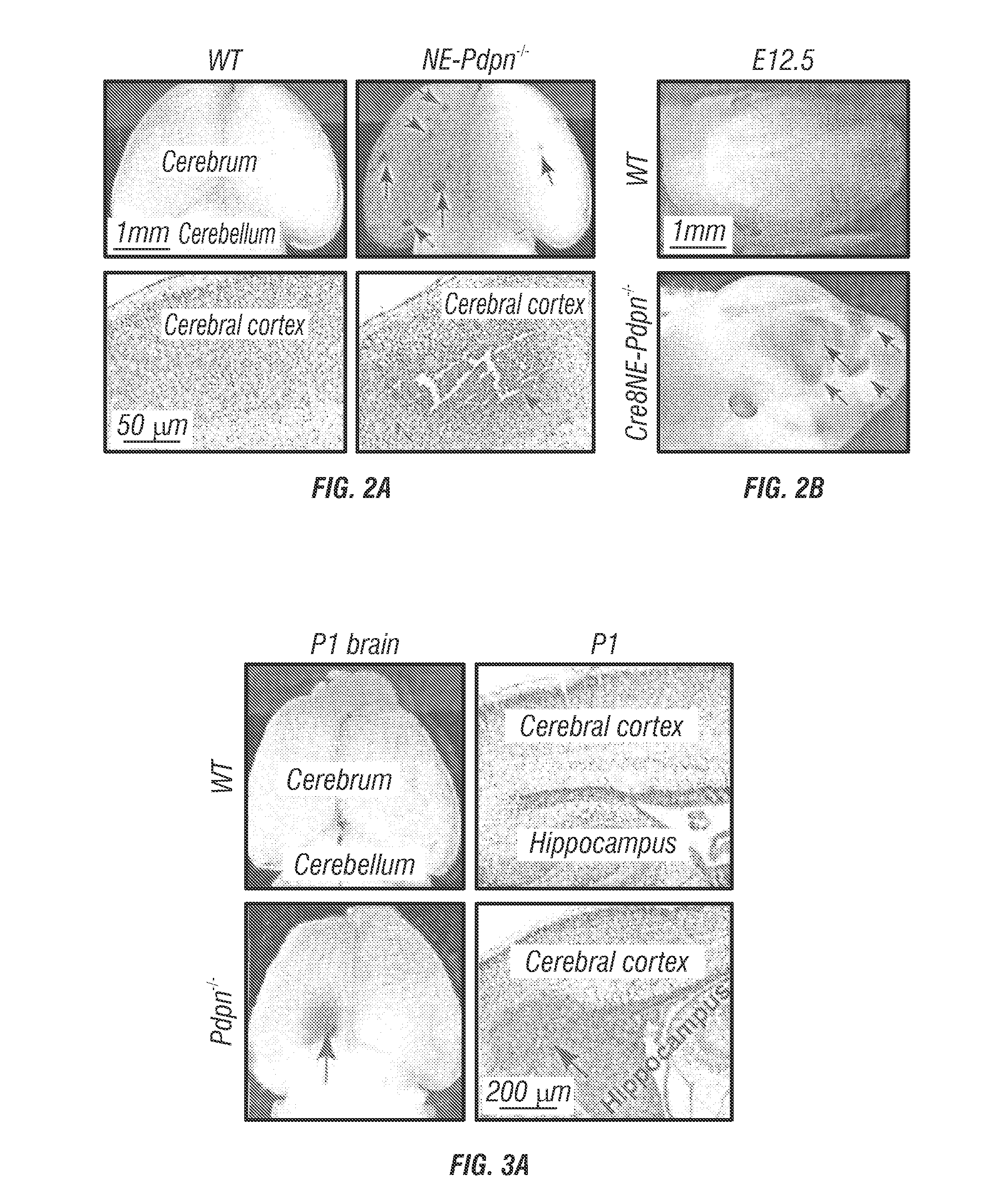 Modulation of podoplanin mediated platelet activation