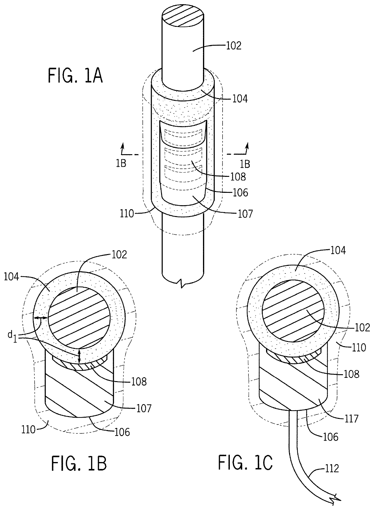 In situ assembly of a bi-directional neural interface