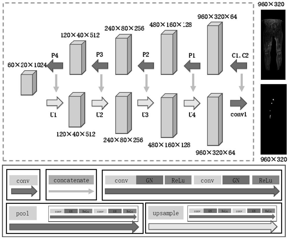 Deep vein thrombosis thrombolytic effect prediction method and system, storage medium and terminal