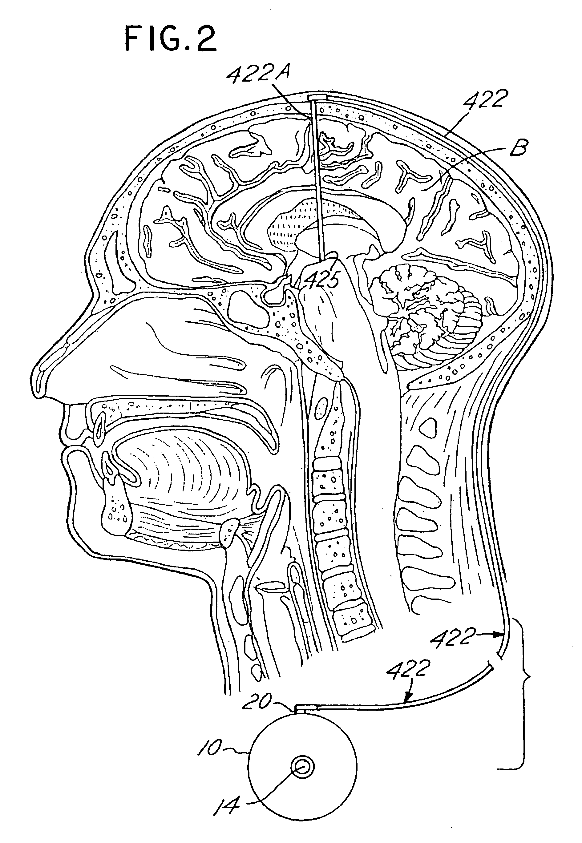 Regulation of neurotrophins