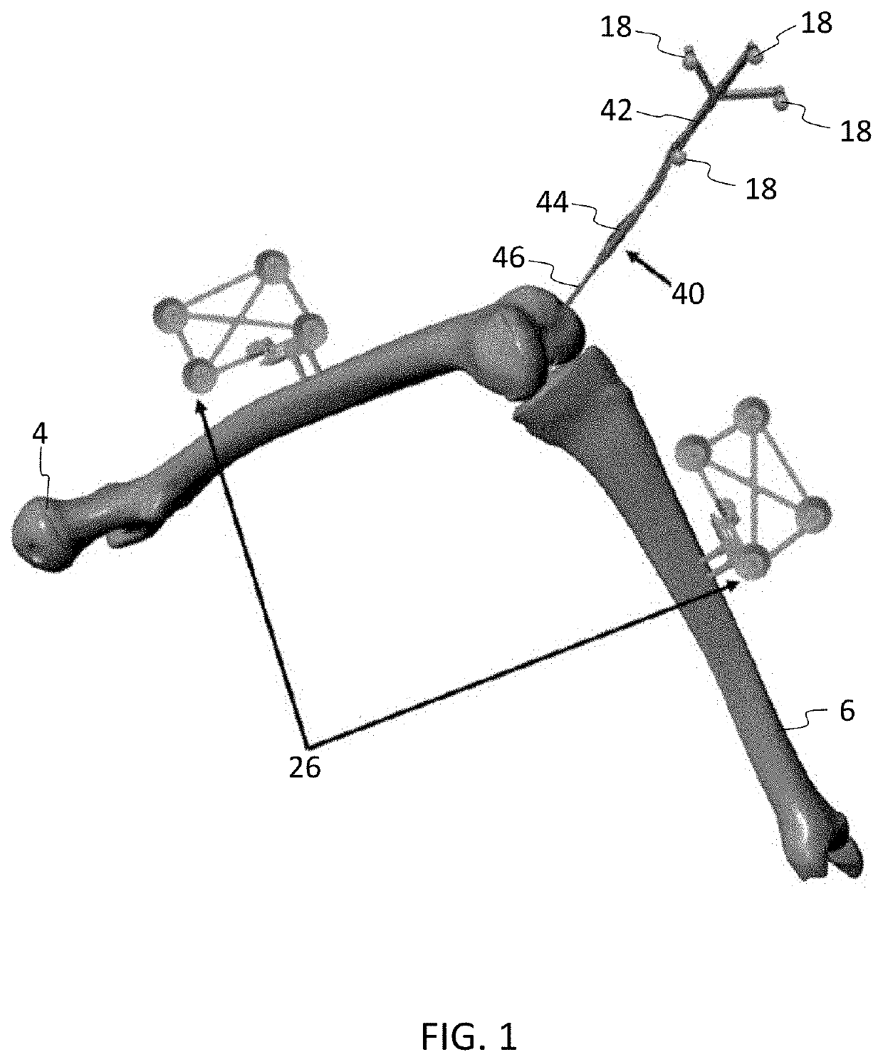 Instruments for navigated orthopedic surgeries