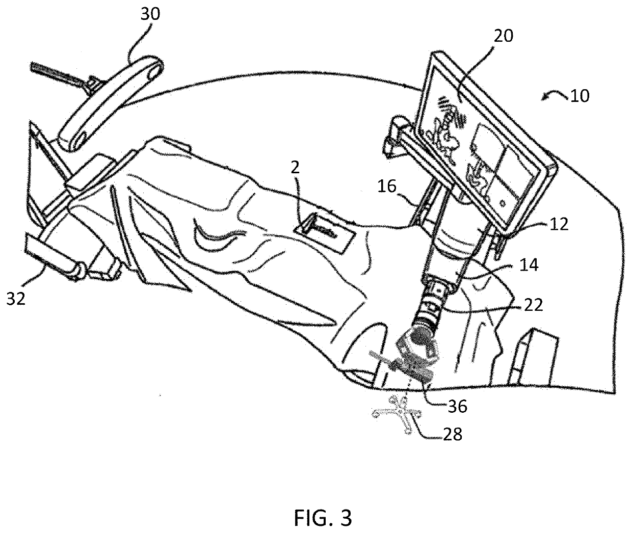 Instruments for navigated orthopedic surgeries