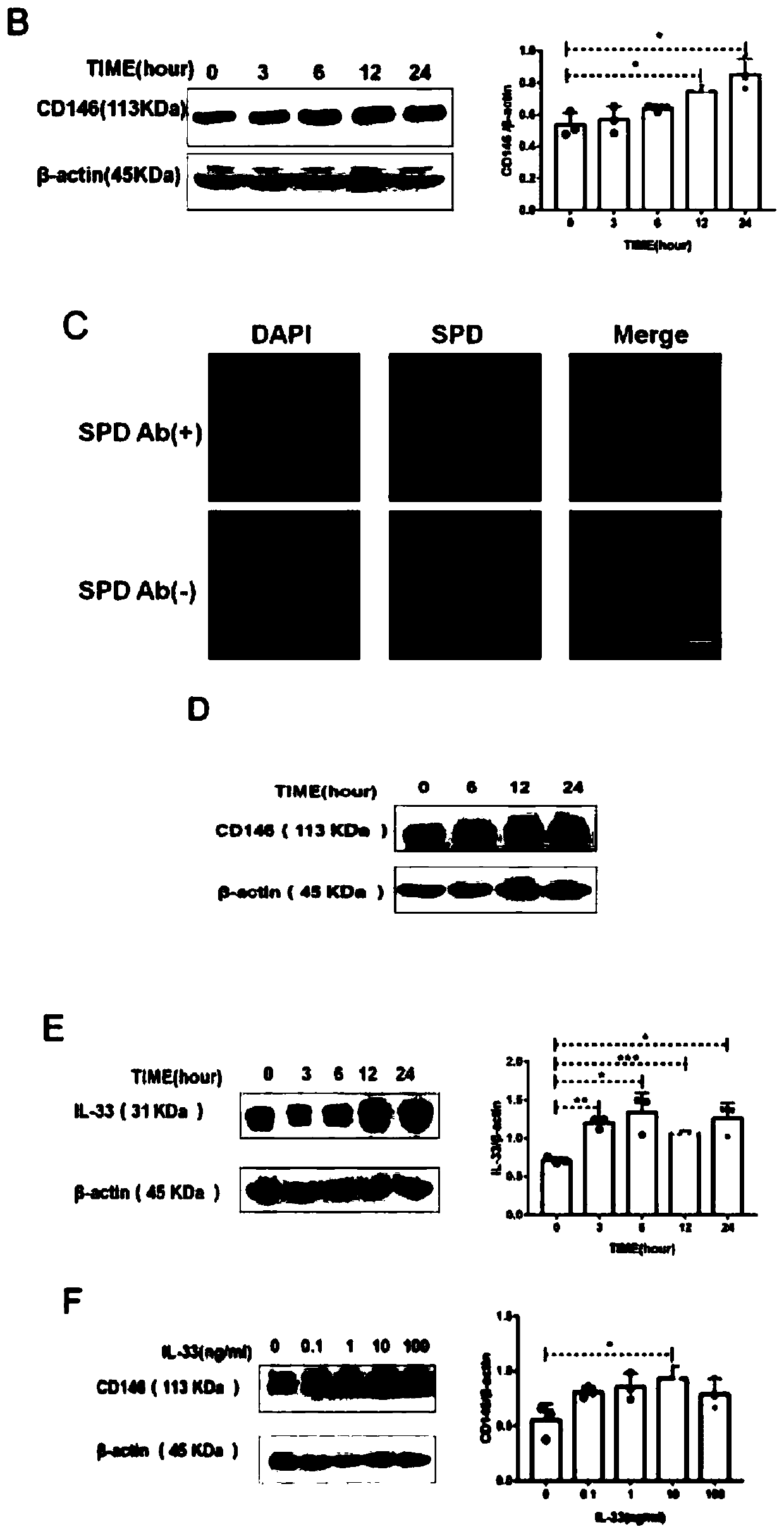 Application of CD146 as treatment target point to preparation of medicines for treating asthma airway remodeling