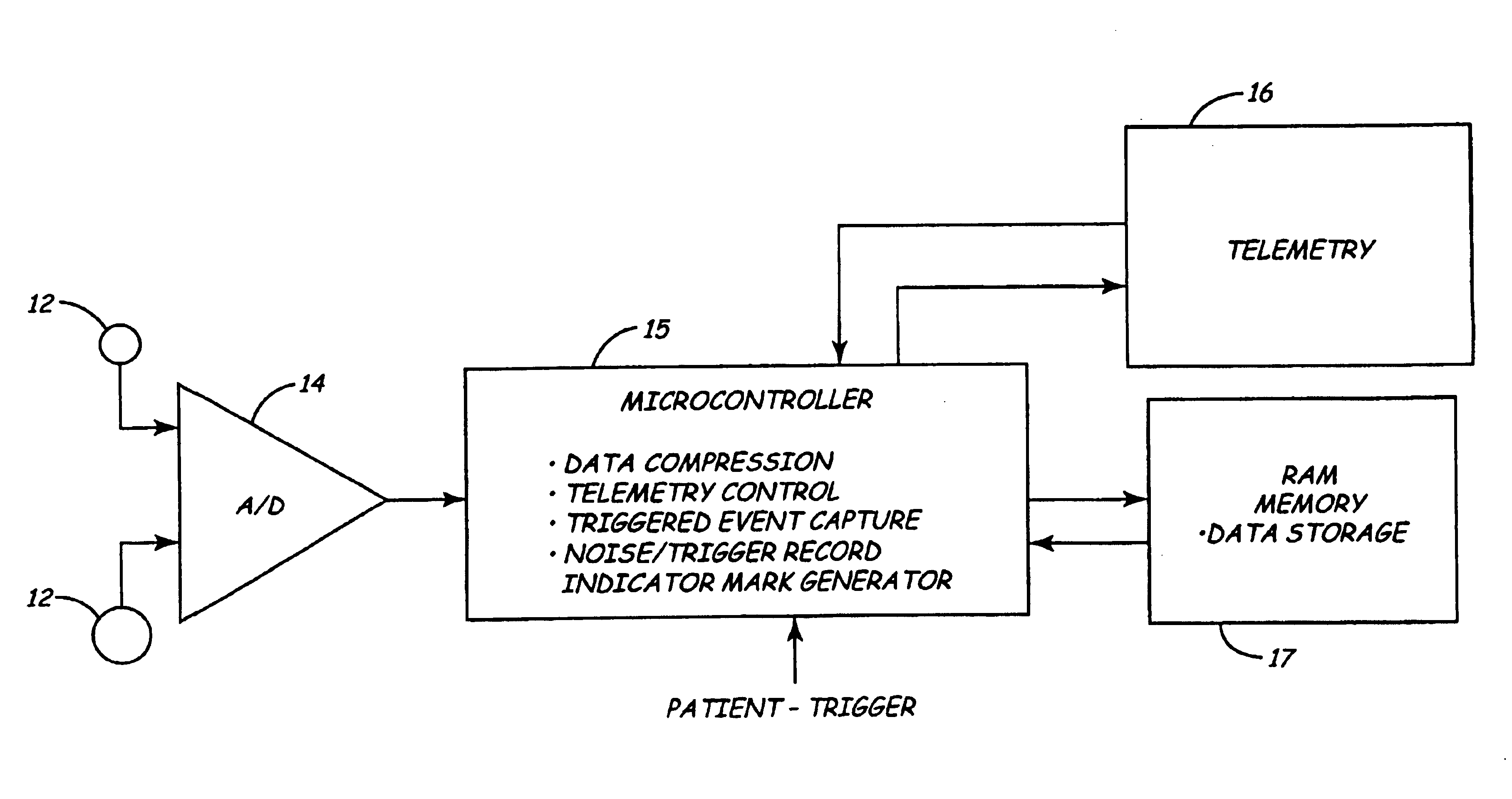 Medical device ECG marker for use in compressed data stream