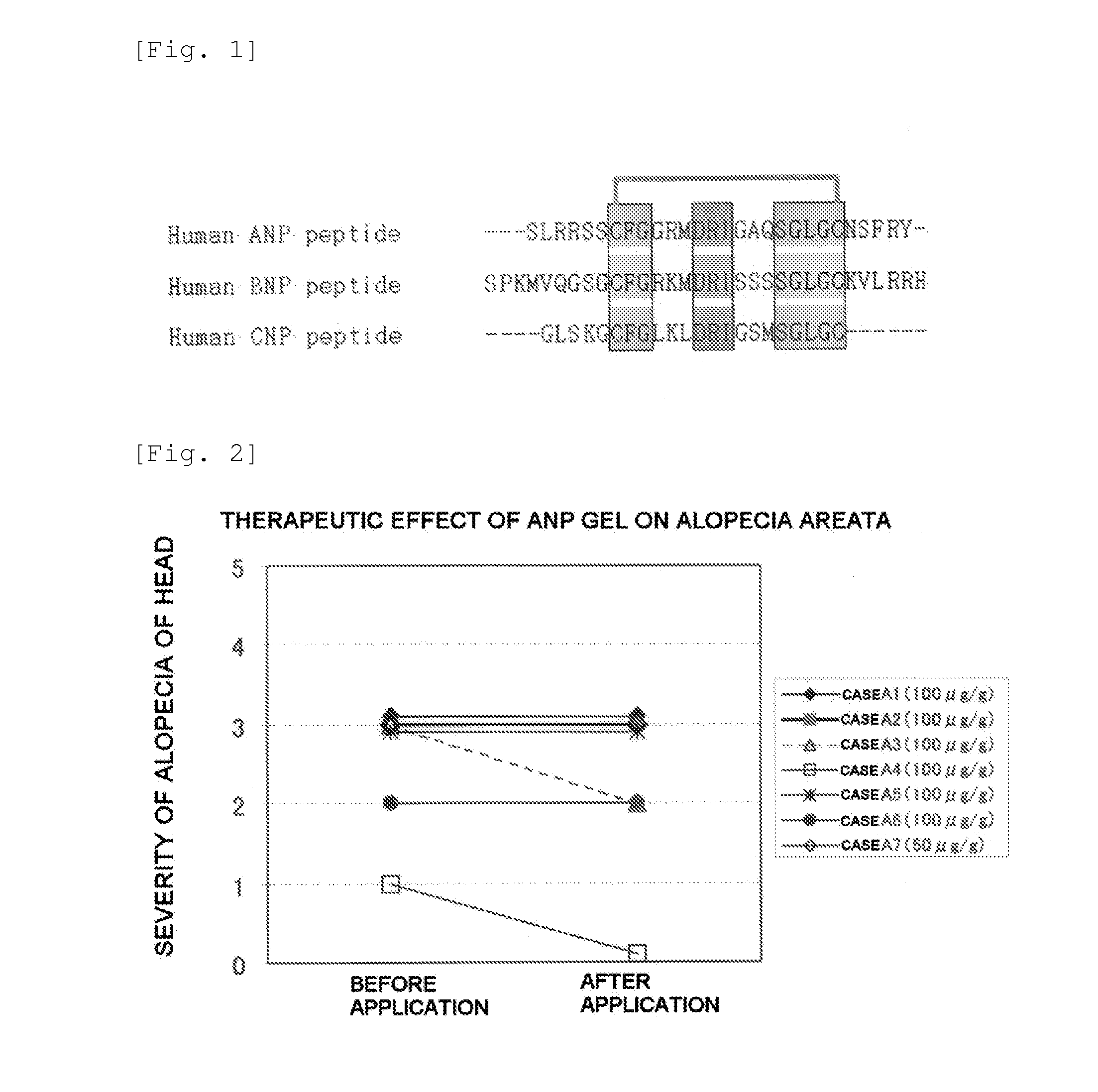 Agent for the treatment of alopecia