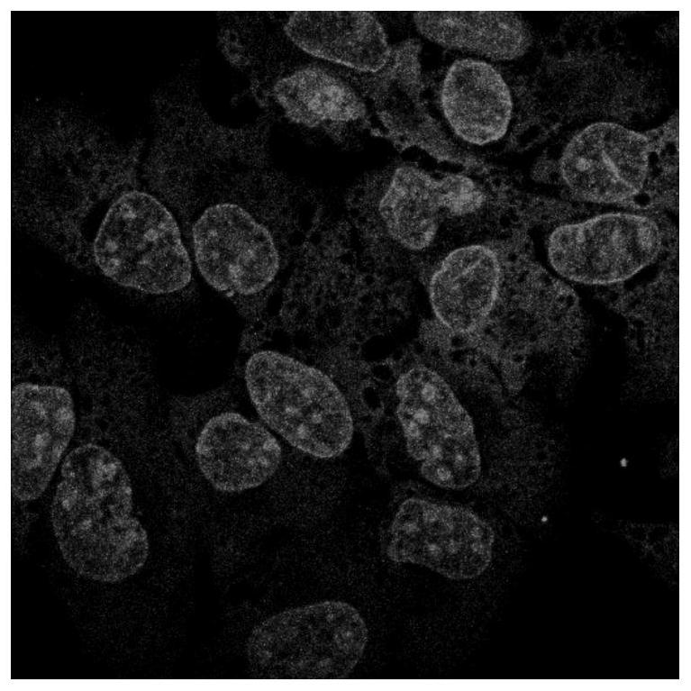 A kind of α-pinene-based nuclear fluorescent probe and its preparation method and application