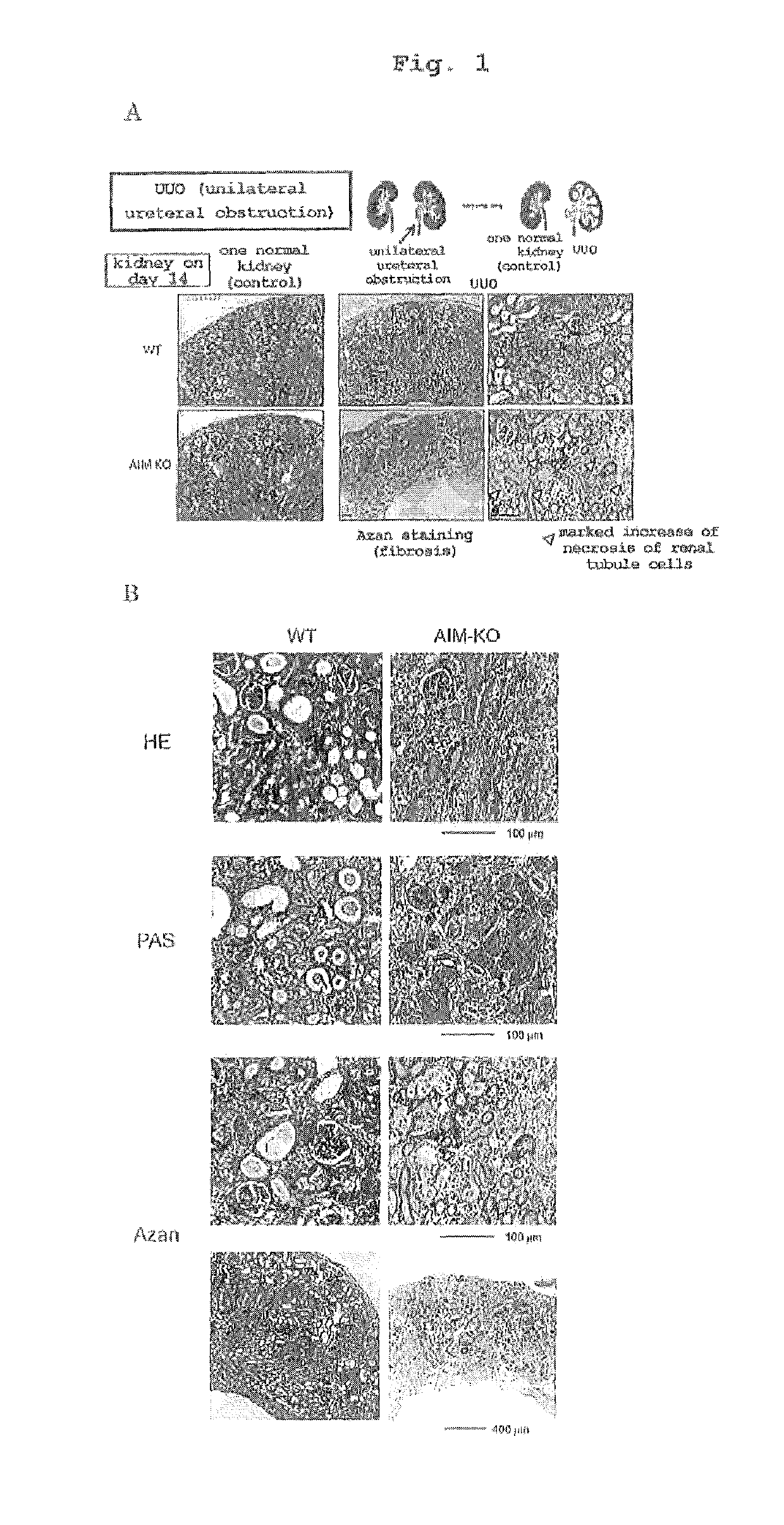 Preventive or therapeutic agent for kidney disease