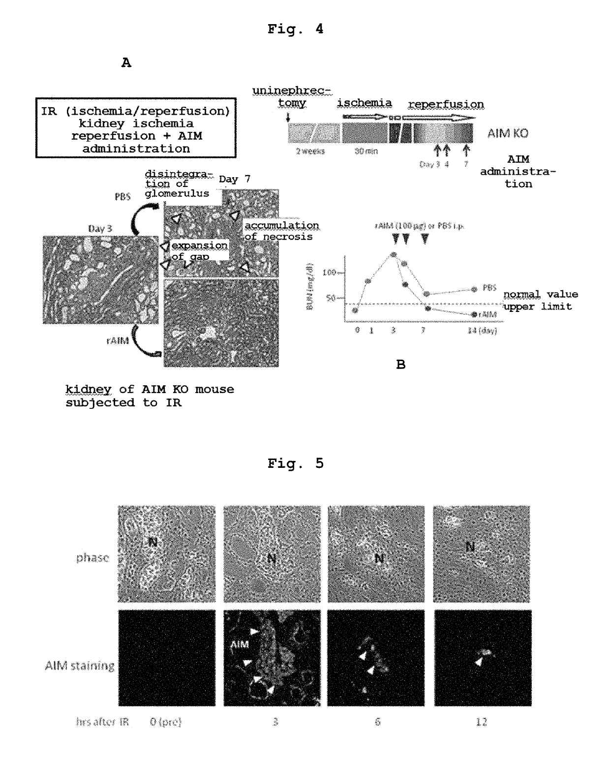 Preventive or therapeutic agent for kidney disease