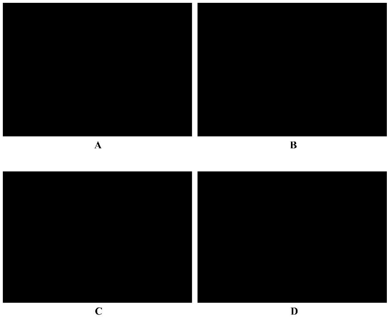 Application of IL-6 in preparation of drug for treating lumbar disc herniation